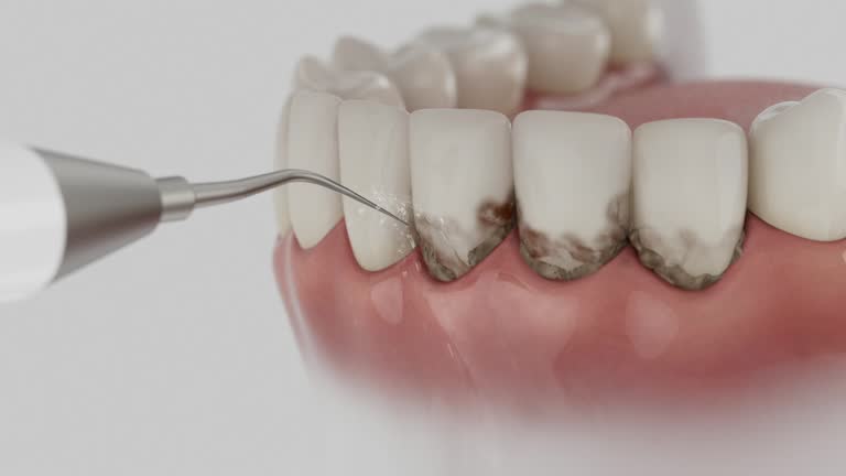 Trusted Tooth Extraction service in Okmulgee, OK - Dentist Open Now